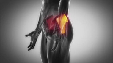insan gluteus medius kasları