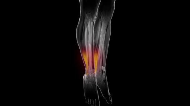 Muscles achilles humains — Video