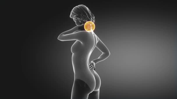 Mulher tem dor na coluna vertebral — Vídeo de Stock