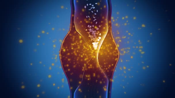 Aterosclerosi nel ginocchio umano — Video Stock