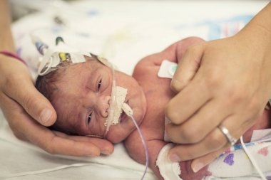Klinik burnuna borularda ile yeni doğan bebek portresi