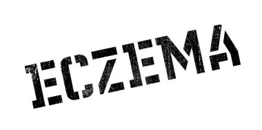 Egzama pencere boyutu