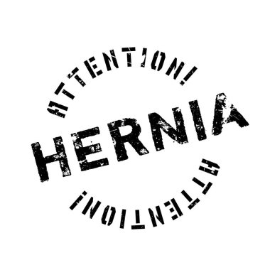 Fıtık pencere boyutu