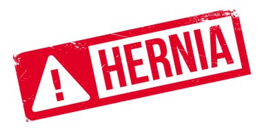 Fıtık pencere boyutu