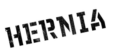 Fıtık pencere boyutu