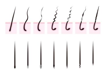 Kıvırcık saçlı. Saç loss.hair kök.