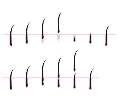 Gözenekler saç döngüsü kesit görünümü