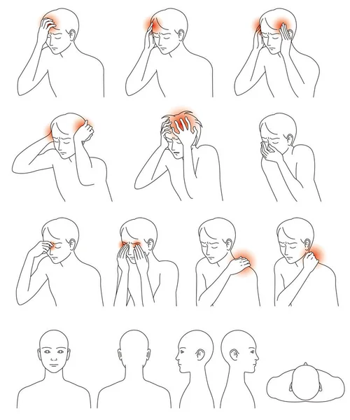 Cefaleias e rigidez do pescoço —  Vetores de Stock