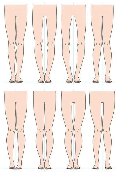 Форма ног — стоковый вектор