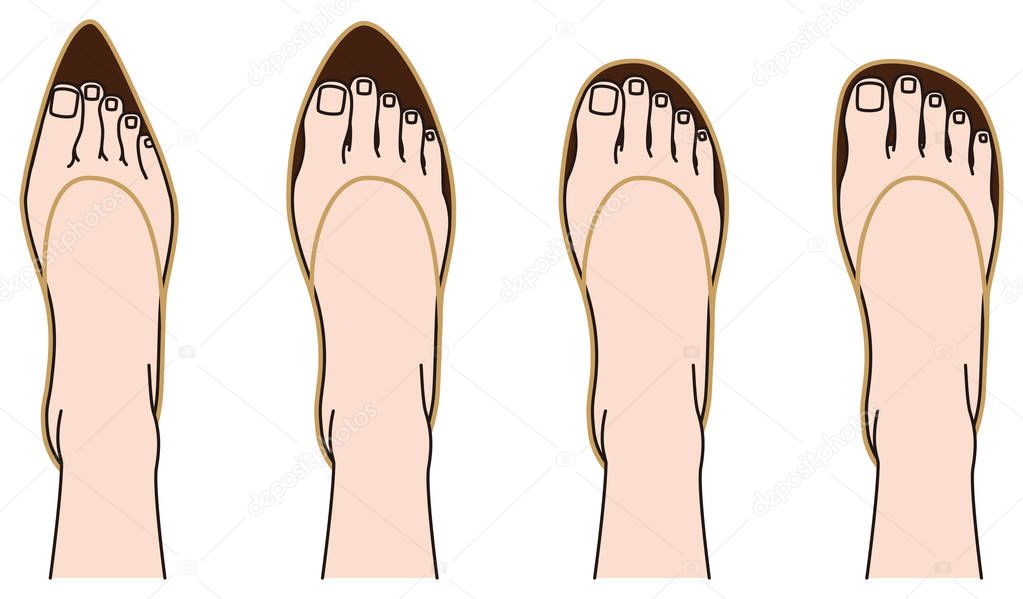 Shoes of shape and feet