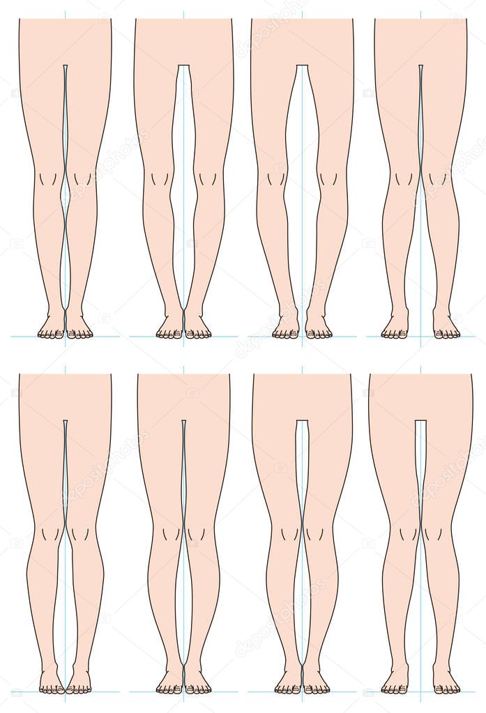 Shape of the legs