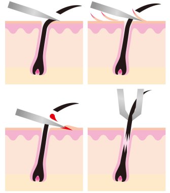 Saç dökülmesi ve görüntü sketch kendini Mao sorun dışında