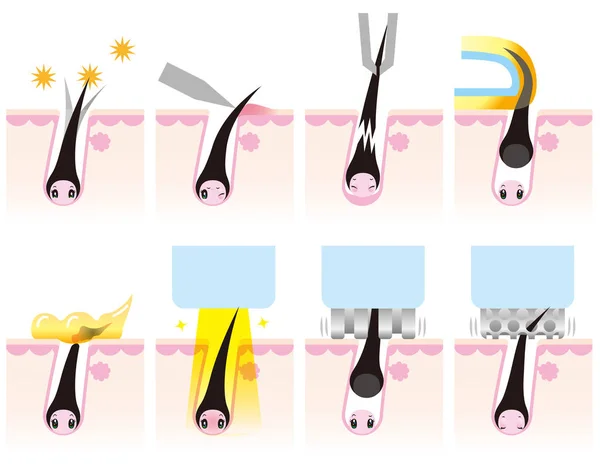 Eliminación del cabelloexcepto tu mismo anime — Vector de stock