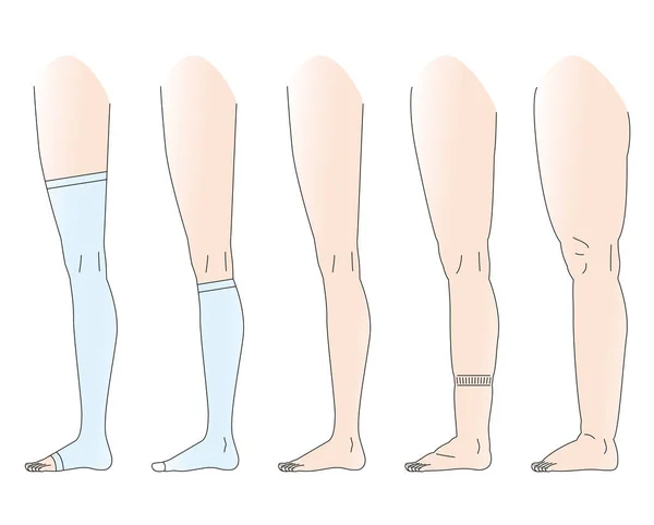 Ноги є набряк ніг набряк — стоковий вектор