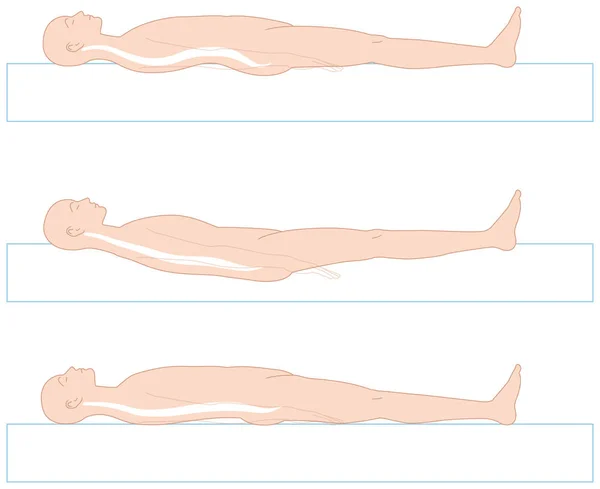 硬いベッド、柔らかいベッドと体 — ストックベクタ