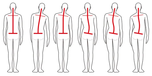 Dos humain forme colonne vertébrale — Image vectorielle