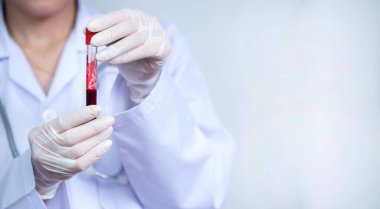 Kandaki anormallikleri ve çeşitli enfeksiyonları bulmak için kadın bir doktorun eli.