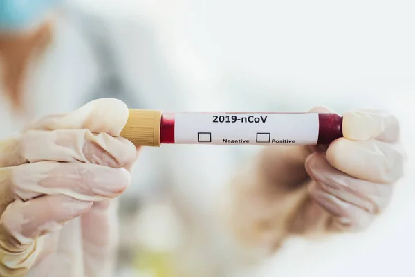 Prueba Covid Muestra Laboratorio Análisis Sangre Para Diagnóstico Nueva Infección — Foto de Stock