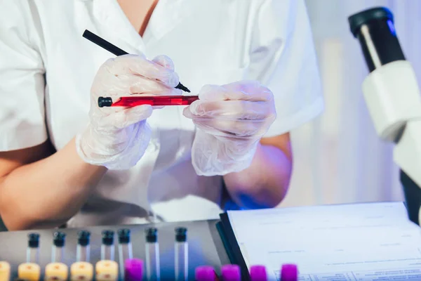 Asistente Técnico Laboratorio Analizando Una Muestra Sangre Tubo Ensayo Laboratorio — Foto de Stock