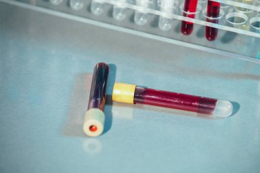 Test tüpleri. Tıbbi malzemeler. Masanın üzerinde renkli sıvılarla test tüpleri var..