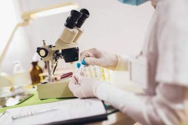 Laboratuvarda, analiz ve Covid-19 enfeksiyonlu diyabet örneği için biyolojik tüpü olan bir doktor var..