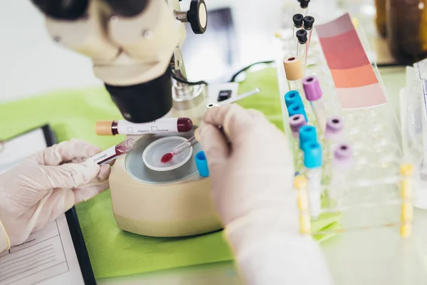 Medico Laboratorio Con Tubo Biologico Analisi Campionamento Covid Disea Infettivo — Foto Stock