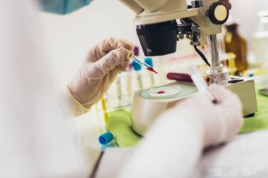 Laboratuvarda, analiz ve Covid-19 enfeksiyonlu diyabet örneği için biyolojik tüpü olan bir doktor var..