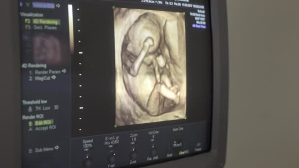 Dítě je vidět pomocí ultrazvukové zařízení — Stock video