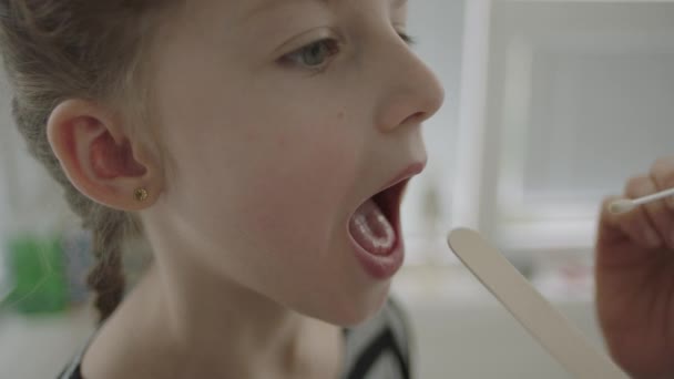 口内射精を強行されコロナウイルス検査中の少女患者のスローモーションクローズアップ Corvid19 — ストック動画