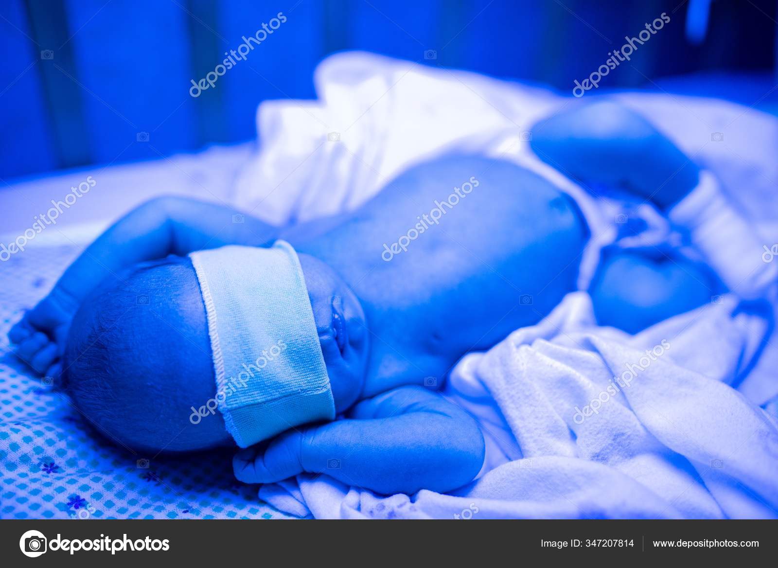синяя лампа для новорожденных от желтушки. лампа от желтушки для новорожденного напрокат. желтушка у новорожденных фототерапия. синяя лампа для новорожденных. ребенок под ультрафиолетом.