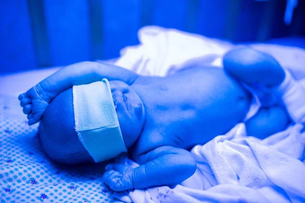 Nouveau Ayant Traitement Contre Ictère Sous Lumière Ultraviolette Bébé Niveau — Photo