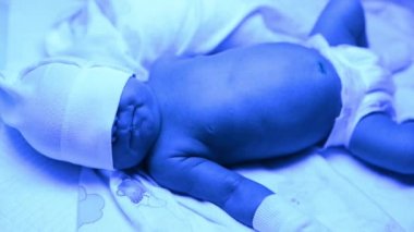 Ultraviyole ışık altında sarılık tedavisi gören yeni doğmuş bir bebek sarılık seviyesini düşürmek için mavi ışıkta yatan yüksek seviyedeki bilirubine sahiptir. Güvenli tıbbi prosedürler
