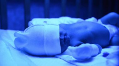 Ultraviyole ışık altında sarılık tedavisi gören yeni doğmuş bir bebek sarılık seviyesini düşürmek için mavi ışıkta yatan yüksek seviyedeki bilirubine sahiptir. Güvenli tıbbi prosedürler