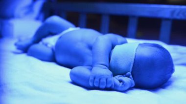 Ultraviyole ışık altında sarılık tedavisi gören yeni doğmuş bir bebek sarılık seviyesini düşürmek için mavi ışıkta yatan yüksek seviyedeki bilirubine sahiptir. Güvenli tıbbi prosedürler