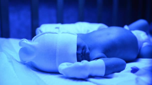 Новорожденный Лечением Желтухи Ультрафиолетовым Светом Ребенок Имеет Высокий Уровень Билирубина — стоковое видео