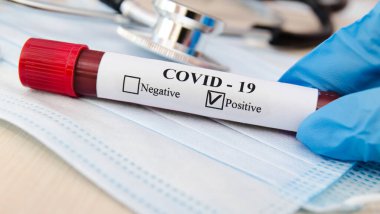 Coronavirus kan testi konsepti. Doktor eldiveni içinde, laboratuvar masasının üzerinde Coronavirus pozitif kan taşıyan bir test tüpü tutuyor. Tıbbi konsept