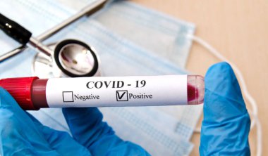 Coronavirus kan testi konsepti. Doktor eldiveni içinde Coronavirus 'un pozitif kanıyla laboratuvar masasının üzerinde test tüpü tutuyor.