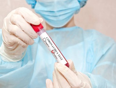 Hemşire 2019 nCoV analizi için test tüpünü kanla tutuyor. Coronavirus pozitif kan testi konsepti