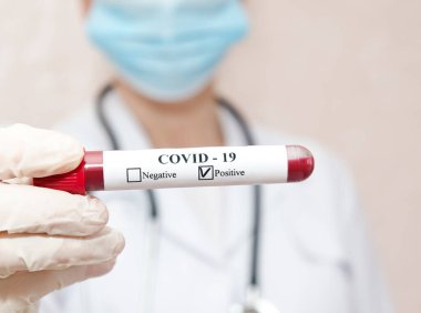 Hemşire 2019 nCoV analizi için test tüpünü kanla tutuyor. Coronavirus pozitif kan testi konsepti