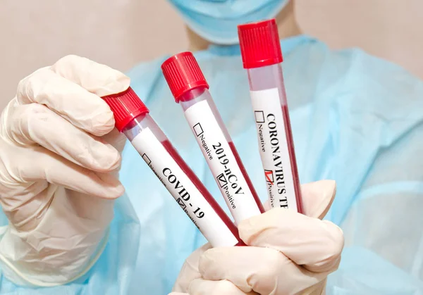 Pielęgniarka Trzyma Probówkę Krwią Analizy 2019 Ncov Koncepcja Badania Krwi — Zdjęcie stockowe