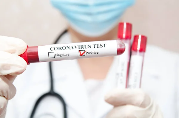 Infermiera Possesso Provetta Con Sangue Analisi 2019 Ncov Coronavirus Concetto — Foto Stock