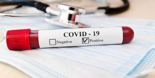 Coronavirus Kan Testi Konsepti Laboratuvar Masası Üzerinde Koronavirüs Pozitif Kan — Stok fotoğraf