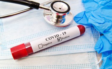 Coronavirus kan testi konsepti. Laboratuvar masası üzerinde koronavirüs pozitif kan olan test tüpü. Tıbbi konsept
