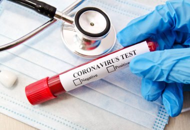Coronavirus Covid-19 kan testi konsepti. Doktor eldiveni içinde, laboratuvar masasının üzerinde Coronavirus pozitif kan taşıyan bir test tüpü tutuyor. Tıbbi konsept