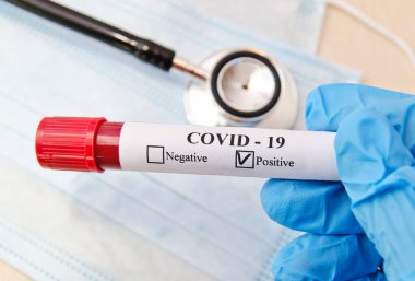 Coronavirus Covid-19 kan testi konsepti. Doktor eldiveni içinde, laboratuvar masasının üzerinde Coronavirus pozitif kan taşıyan bir test tüpü tutuyor. Tıbbi konsept
