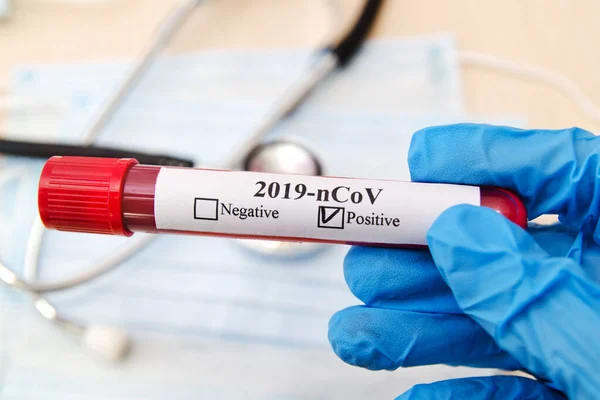 Concetto Analisi Del Sangue Coronavirus Covid Mano Dottore Guanto Medico — Foto Stock