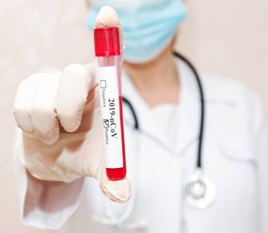 Hemşire 2019 nCoV analizi için test tüpünü kanla tutuyor. Coronavirus pozitif kan testi konsepti