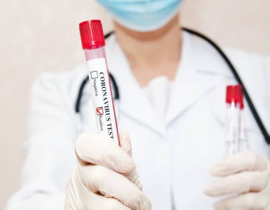 Hemşire 2019 nCoV analizi için test tüpünü kanla tutuyor. Coronavirus pozitif kan testi konsepti