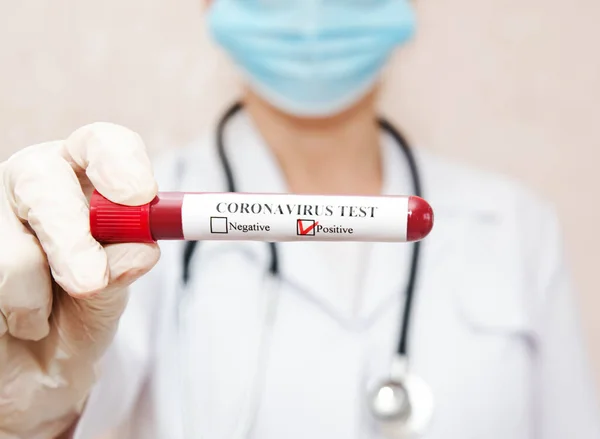 Krankenschwester Hält Reagenzglas Mit Blut Für 2019 Ncov Analyse Coronavirus — Stockfoto