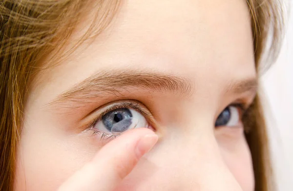 Little Girl Child Putting Contact Lens Her Eye Closeup Vision — Stock Photo, Image